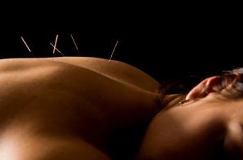acupuncture_works_1-12-2010