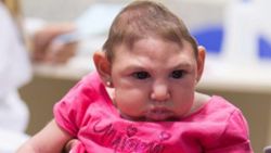 zika 1-2-2016